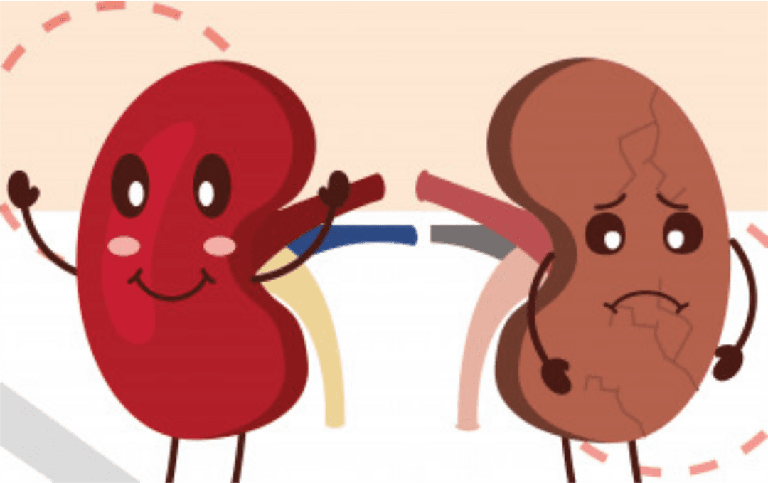 Chronic Kidney Disease (CKD)